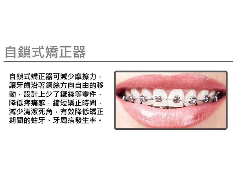 金屬透明陶瓷滑蓋矯正