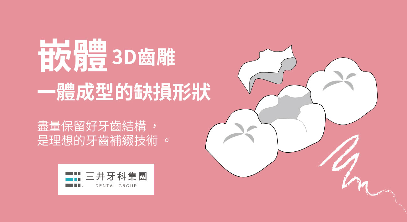 3D齒雕/嵌體、一體成型的缺損形狀瓷塊