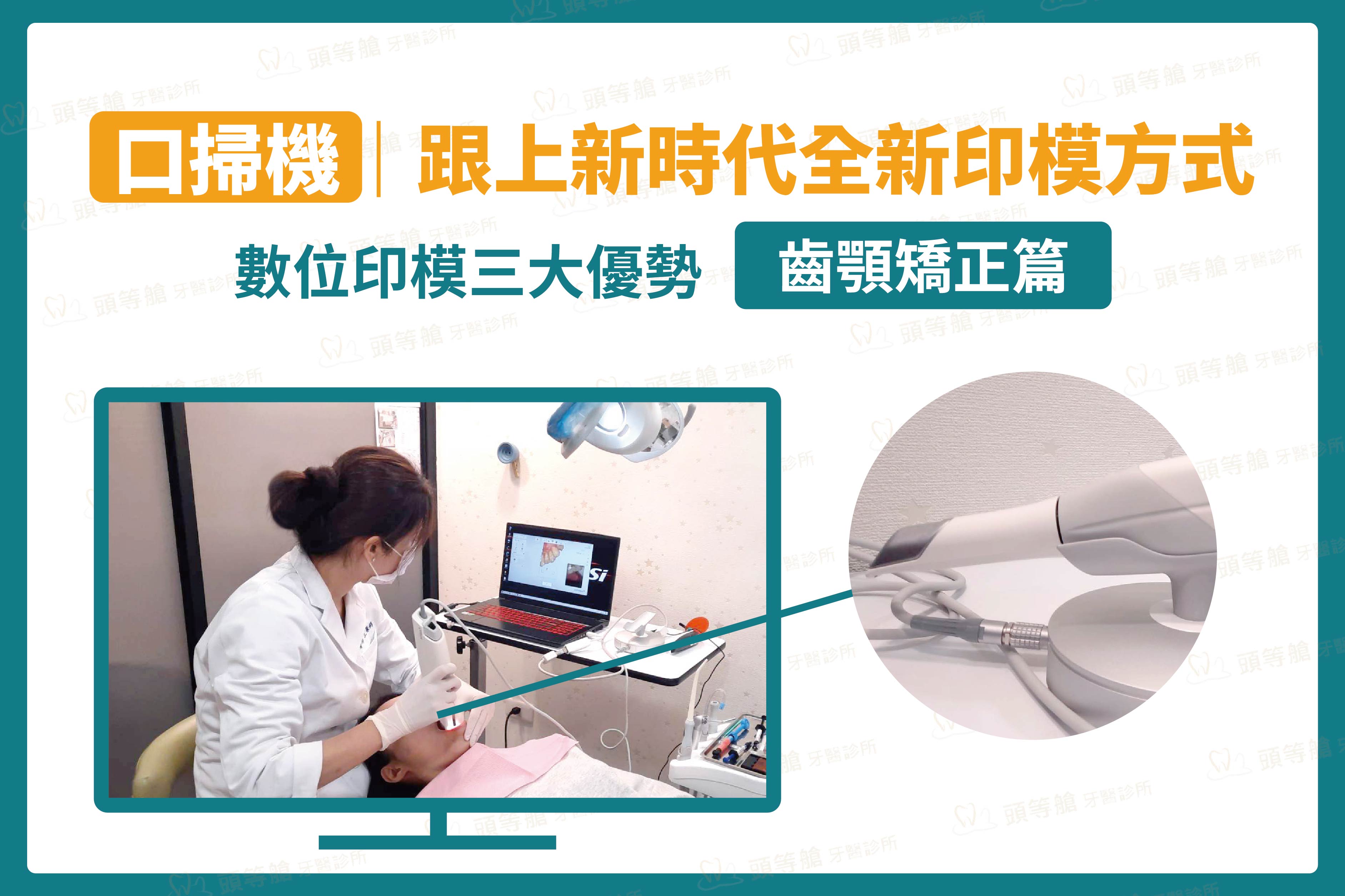 口掃機｜跟上新時代全新印模方式